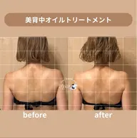 【慢性首肩こり・体のだるさが抜けない方へ】美背中オイルトリートメント モニター