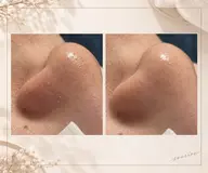 毛穴洗浄💆‍♀️毛穴引き締めパック付き✨✨
