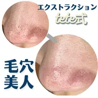 即実感🌷毛穴エクストラクション(2箇所)+ヒト幹細胞潤い引き締めパック+顔・ヘッド・デコルテマッサージ付🌷