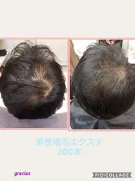 増毛エクステ200本