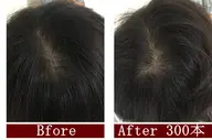 ヘアーループ増毛 300本