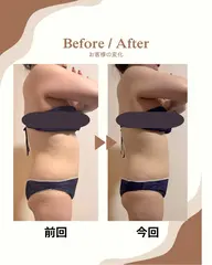 【初回限定】全身痩身エステ