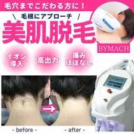 【無料モデル】VIO脱毛or顔脱毛