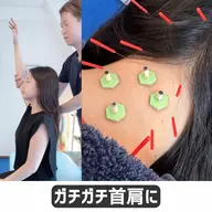 【ガチガチ首肩・眼精疲労に】鍼×整体|首肩集中50分