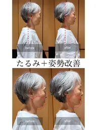 【姿勢&フェイスライン改善】小顔矯正+姿勢矯正50分 価格:3980円