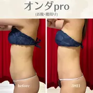 【お腹・腰】《当店イチオシ🩵》お腹なら絶対これ‼️浮き輪肉撃退！美くびれ集中ケア🔥