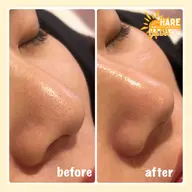 【鼻👃🏻のみ✨】毛穴洗浄×管理栄養士による食生活アドバイス付き