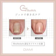 【HeySwitch導入★】韓国発の巻き爪ケアジェル🎵親指1本¥4.400、他の指1本¥2.200