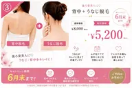 【女性限定】後ろ美人☆背中＋うなじ脱毛セット