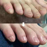 (フット)お爪整え+甘皮処理/みちがえる足爪コース
