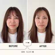 【痛い施術が苦手な方へ】頭・首・お顔を整える小顔ケア40分/むくみ・まぶたの重さ・フェイスライン