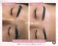 ご新規様限定✨ワックス脱毛/眉毛カット🫶🏽