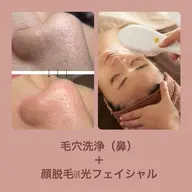 【完全都度払い】毛穴洗浄(鼻)+顔脱毛or光フォト