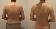 【筋膜ケア】背中+デコルテ首+腕(60分)