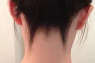 【S部位脱毛】 お問合せのみ