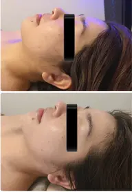 【お疲れ顔には】背中コルギ+姿勢矯正+フェイシャルコルギのトリプルですっきり小顔&すっきり上半身