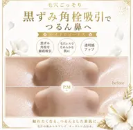 【鼻の毛穴集中】ハイドロビーナス黒ずみ・角栓ごっそり吸引 ¥5,500