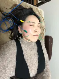 小顔マッサージ+美容針+電気🌟