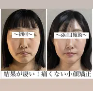 年末年始までに本気で顔痩せしたい方へ☆痛くない小顔矯正で歪み・浮腫み・エラ張り・左右非対称改善☆1ヶ月3回コース