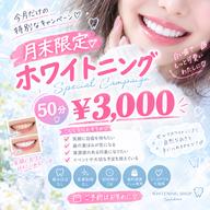 今月最後のお得なチャンス!50分照射 ¥3,000 笑顔に自信を🦷✨️白い歯で第一印象UP!!