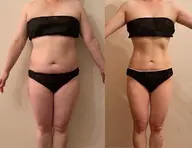 ✨女性人気◎気になる部位集中ケア🌸3ヘッド搭載の最新温感美容マシン+ハンドマッサージでスッキリ🌸45分+10分無料