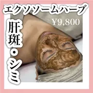 【剥離なし!肌の再育成】最新ハーブピーリング