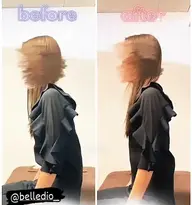 🌸顔+体の全身調整🌸姿勢矯正+美容鍼