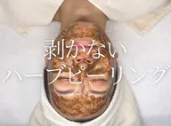 【ポツポツ毛穴•大人ニキビ•シミ予防に】ハーブピーリング×毛穴洗浄で肌質改善コース