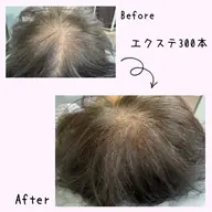 薄毛で悩んでる方向けの増毛エクステ 200〜300本