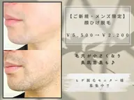 【ご新規・メンズ限定】顔ひげ脱毛　通常￥5,500→￥2,200