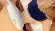 イオン導入脱毛
