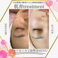 陶肌トリートメント小顔 美白コース💎