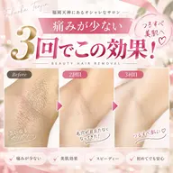 全身➕VIO5回プラン