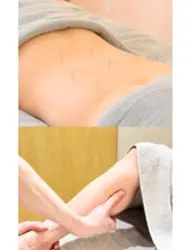 脚かるケア 腰・お尻(上部)の鍼+ふくらはぎオイル 60分