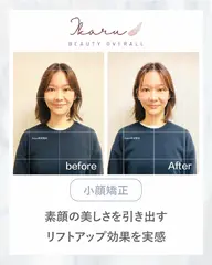 【ミニモ限定|9月口コミ割】人気No.1小顔矯正+全身姿勢矯正60分|小顔・猫背・巻き肩・首肩こり・骨盤
