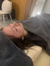 【✨美容人気No.1✨ 】リフトアップ美容鍼 45分