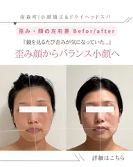 🌿 30代限定 3ヶ月間(6回来店条件)90分【顔の左右差解消/首や頭のねじれ解消小顔ヘッドスパ】