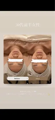 【美白の最上級エステ🤍】透明感あふれるうるツヤ肌へ✨ビューティー美白エステ🫧輝く水光肌へ💡
