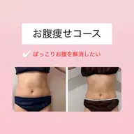 お腹引きしめコース〈腰まわり・お腹 11,000円〉