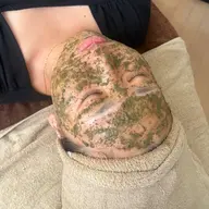 ドライヘッドスパ付き💆‍♀️✨ハーブピーリング🌿(剥離なし)