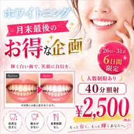 8月ラスト6日間限定！今月の締めくくりに是非☆1回のホワイトニングでも効果実感！人数制限あり・なくなり次第終了！