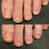 フットネイルケア