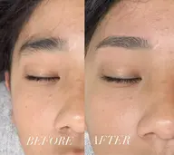 メンズ眉毛ワックス脱毛
