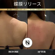 【🦋肩甲骨ライン×姿勢美】蝶膜リリース|背中・首・肩を整える背中特化ケア〈都度払いOK〉