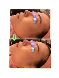 【NEW❣️】暑くなってきて毛穴の開きや詰まりが気になる方必見👀✨徹底的に毛穴ケアコースでつや玉美肌へ🥰