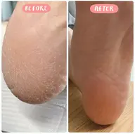 ツルツル角質ケア+ワンカラー🦶