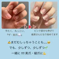 深爪緩和・育成🌱『艶ありクリアor自爪風マット仕上げ』【ホームケアオイル付き⭐️】