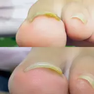 【8月限定!新規の方専用メニュー】夏に向けて足爪ケア🫧長さカットから甘皮ケアまで✨️