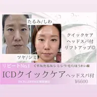 韓国整形級🇰🇷艶肌インセルダム クイックフェイシャル×ヘッドスパ🌿商品相談ももちろん可能💭リフトアップ/毛穴