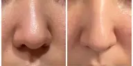 【大人気💓ザラつき汚れゴッソリ洗浄✨】イチゴ鼻改善🔥毛穴オイルアップ&スクライバー洗浄&オイルマッサージ😊